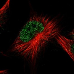 ATG2B Antibody, Novus Biologicals 0.1mL; Unlabeled:Antibodies, Polyclonal